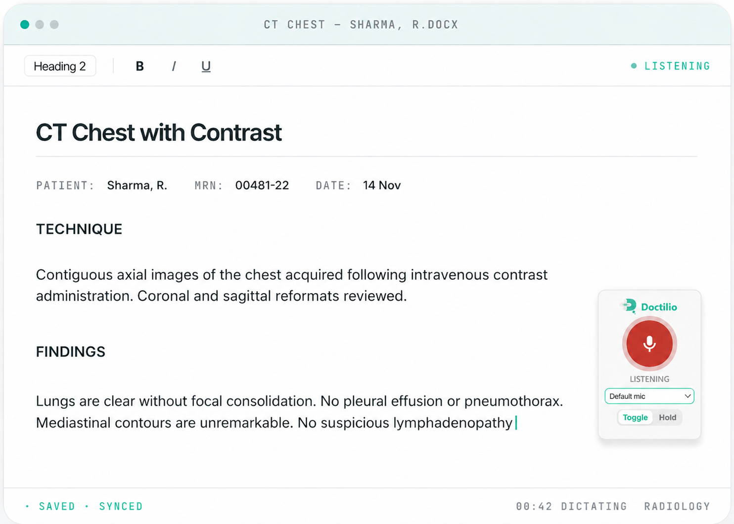 Doctilio desktop widget overlaid on a CT Chest dictation report
